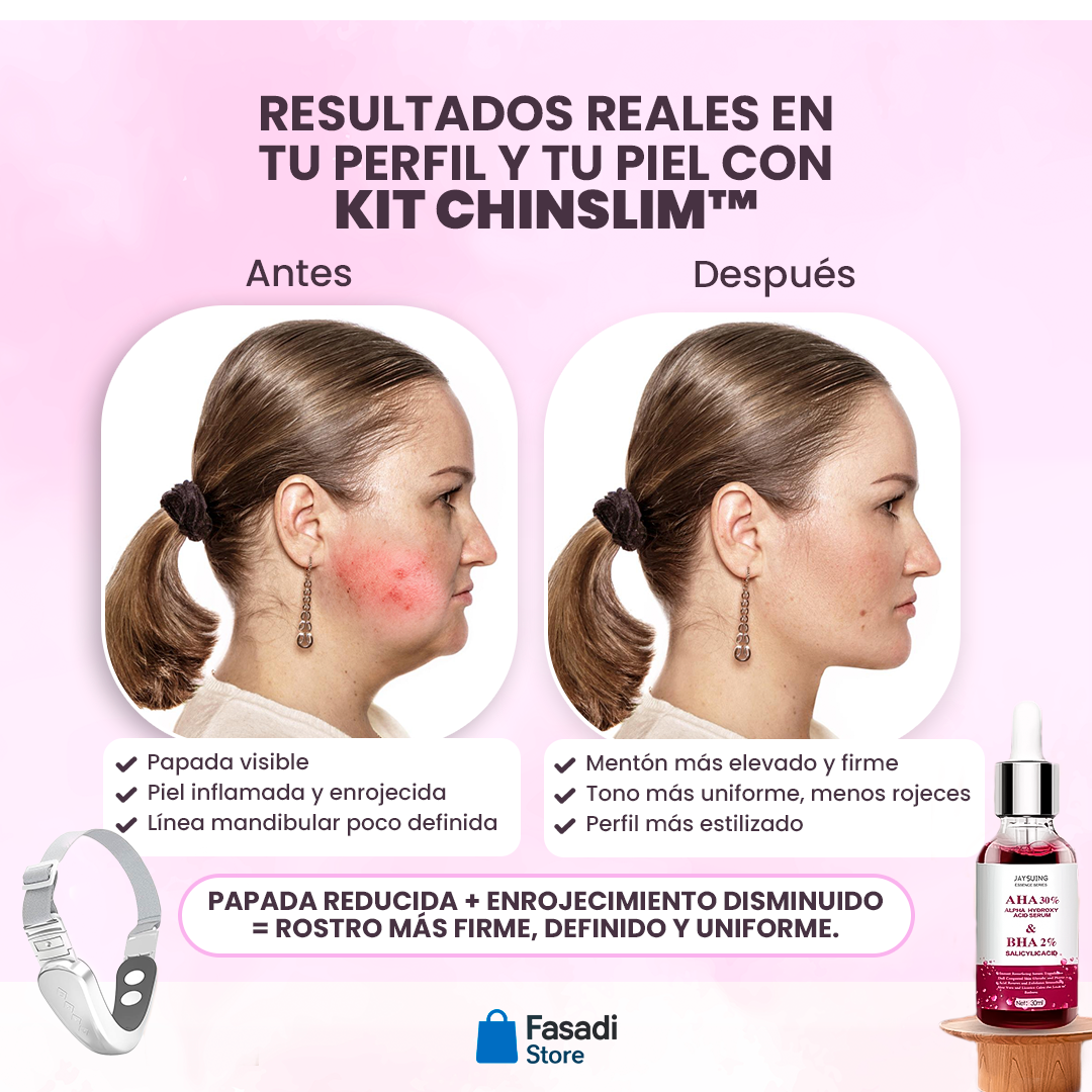 Kit ChinSlim™ - Reduce tu papada y define tu rostro desde casa